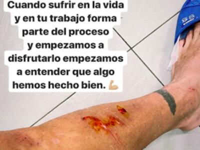 Rincon, che botta in allenamento! “La sofferenza fa capire che abbiamo fatto bene”