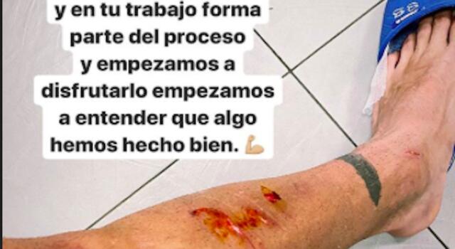 Rincon, che botta in allenamento! “La sofferenza fa capire che abbiamo fatto bene”